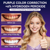 Radiance Teeth Whitening Strips